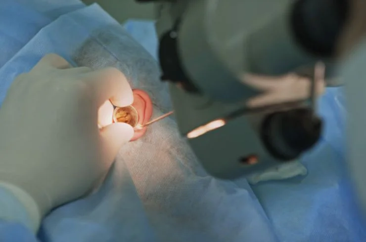 Microscopic Ear Surgery